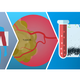Cancerous tumors (left) shed DNA into the bloodstream (center). The Guardant360 test uses digital sequencing technology (right) to comprehensively profile over 70 cancer-related genes, which provides information that can guide treatment selection for patients with advanced cancer. (Graphic: Guardant Health)